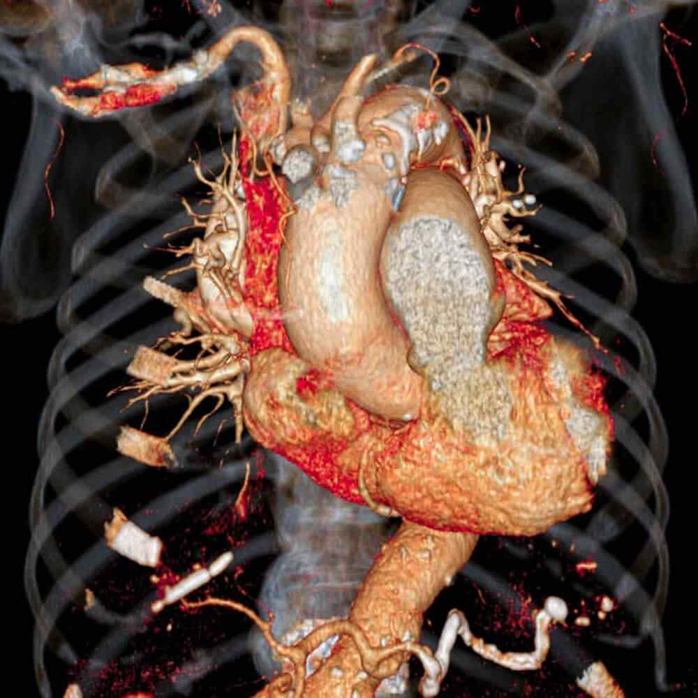 https://max.erwinmagbero.com/wp-content/uploads/2021/08/inner_image_03-1.jpg
