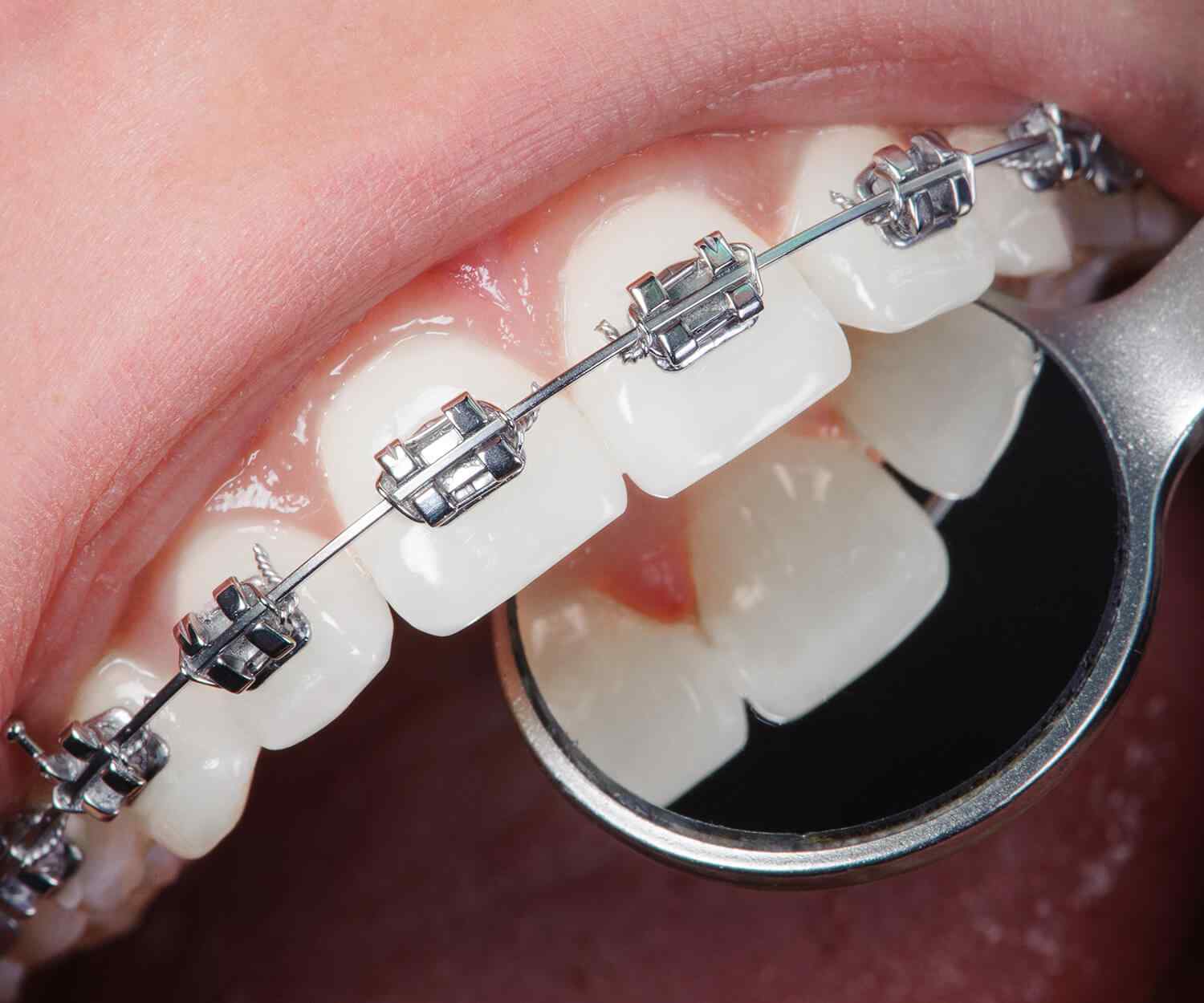 https://max.erwinmagbero.com/wp-content/uploads/2021/10/card_image_home_03-03.jpg